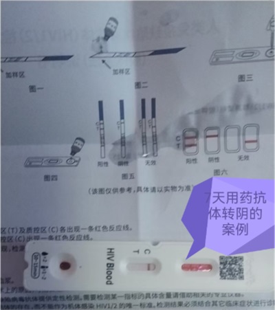 命急丸世界唯一；HIV七天有抗体转阴